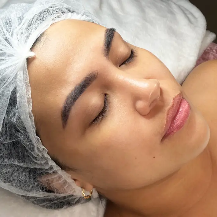Revitalización Facial