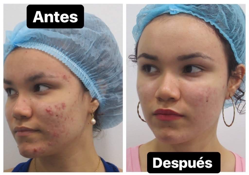 Sofia Nieto antes y después de su transformación