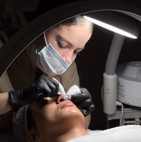 Extracción facial profesional anti-acné Glow Skin